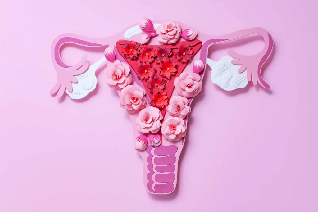 PCOS